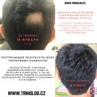 TRICHOLOGIE V PRAZE Трихолог в Праге