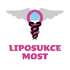 Liposukce Mostecko